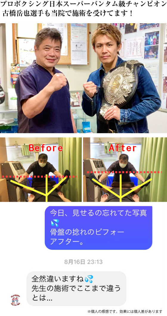 プロボクシング日本スーパーバンダム級チャンピオン 古橋岳也選手も当院で施術を受けてます！※個人の感想です。効果には個人差があります
